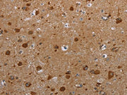 The image on the left is immunohistochemistry of paraffin-embedded Human brain tissue using CSB-PA447962(HIF1AN Antibody) at dilution 1/25, on the right is treated with synthetic peptide. (Original magnification: ×200)
