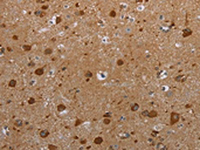 The image on the left is immunohistochemistry of paraffin-embedded Human brain tissue using CSB-PA447962(HIF1AN Antibody) at dilution 1/25, on the right is treated with synthetic peptide. (Original magnification: ×200)