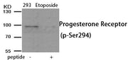 Western blot analysis of extracts from 293 cells treated with Etoposide using Phospho-Progesterone Receptor (Ser294) antibody.The lane on the right is treated with the antigen-specific peptide.