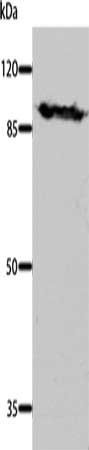 Gel: 8%SDS-PAGE, Lysate: 40 ug, Lane: Mouse brain tissue, Primary antibody: CSB-PA448541(DNM1 Antibody) at dilution 1/700, Secondary antibody: Goat anti rabbit IgG at 1/8000 dilution, Exposure time: 30 seconds
