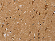 The image on the left is immunohistochemistry of paraffin-embedded Human brain tissue using CSB-PA448660(NDUFS5 Antibody) at dilution 1/20, on the right is treated with fusion protein. (Original magnification: ×200)