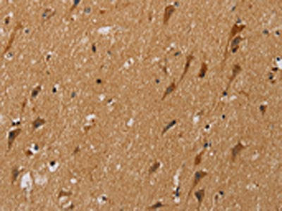 The image on the left is immunohistochemistry of paraffin-embedded Human brain tissue using CSB-PA448660(NDUFS5 Antibody) at dilution 1/20, on the right is treated with fusion protein. (Original magnification: ×200)