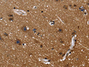 The image on the left is immunohistochemistry of paraffin-embedded Human brain tissue using CSB-PA448974(FGFR1OP Antibody) at dilution 1/40, on the right is treated with fusion protein. (Original magnification: ×200)
