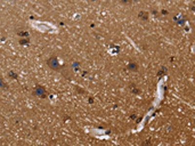 The image on the left is immunohistochemistry of paraffin-embedded Human brain tissue using CSB-PA448974(FGFR1OP Antibody) at dilution 1/40, on the right is treated with fusion protein. (Original magnification: ×200)