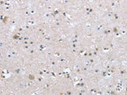 The image on the left is immunohistochemistry of paraffin-embedded Human brain tissue using CSB-PA449302(TRPM3 Antibody) at dilution 1/20, on the right is treated with synthetic peptide. (Original magnification: ×200)