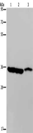 Gel: 8%SDS-PAGE, Lysate: 40 ug, Lane 1-3: Mouse heart tissue, Mouse liver tissue, Mouse stomach tissue, Primary antibody: CSB-PA449427(MDH1 Antibody) at dilution 1/500, Secondary antibody: Goat anti rabbit IgG at 1/8000 dilution, Exposure time: 3...