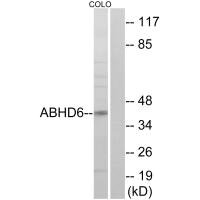 Western blot analysis of extracts from COLO cells, using ABHD6 antibody.