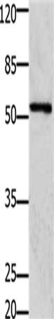Gel: 10%SDS-PAGE, Lysate: 30 ug, Lane: 293T cells, Primary antibody: CSB-PA449746(GFRA1 Antibody) at dilution 1/1250, Secondary antibody: Goat anti rabbit IgG at 1/8000 dilution, Exposure time: 1 minute