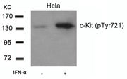 Western blot analysis of extracts from Hela cells untreated or treated with IFN-a using c-Kit(Phospho-Tyr721) Antibody.