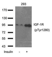 Western blot analysis of extract from 293 cells using IGF-1R(Phospho-Tyr1280) Antibody.
