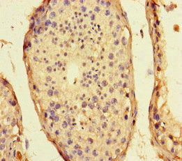 Immunohistochemistry of paraffin-embedded human testis tissue using CSB-PA450720LA01HU at dilution of 1:100