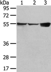 Gel: 6%SDS-PAGE, Lysate: 40 ug, Lane 1-3: 231 and hela cell, mouse liver tissue, Primary antibody: CSB-PA451449(UGT1A10 Antibody) at dilution 1/300 dilution, Secondary antibody: Goat anti rabbit IgG at 1/8000 dilution, Exposure time: 10 seconds