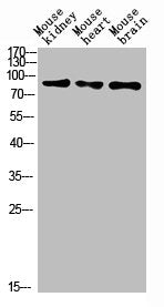 Western Blot analysis of mouse-kidney mouse-heart mouse-brain cells using MUM1 Polyclonal Antibody diluted at 1:1000. Secondary antibody was diluted at 1:20000