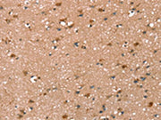 The image on the left is immunohistochemistry of paraffin-embedded Human brain tissue using CSB-PA461485(SYNPO2 Antibody) at dilution 1/50, on the right is treated with synthetic peptide. (Original magnification: ×200)