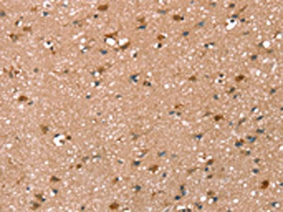 The image on the left is immunohistochemistry of paraffin-embedded Human brain tissue using CSB-PA461485(SYNPO2 Antibody) at dilution 1/50, on the right is treated with synthetic peptide. (Original magnification: ×200)