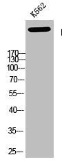 Western blot analysis of K562 using p-Atm (S1981) antibody. Antibody was diluted at 1:500