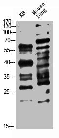 Western Blot analysis of KB, MOUSE-LUNG cells using Antibody diluted at 1000. Secondary antibody was diluted at 1:20000