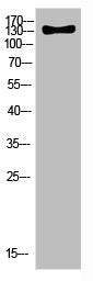Western Blot analysis of HELA cells using Antibody diluted at 500. Secondary antibody was diluted at 1:20000