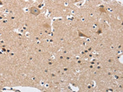 The image on the left is immunohistochemistry of paraffin-embedded Human brain tissue using CSB-PA472830(BUB1 Antibody) at dilution 1/50, on the right is treated with fusion protein. (Original magnification: ×200)