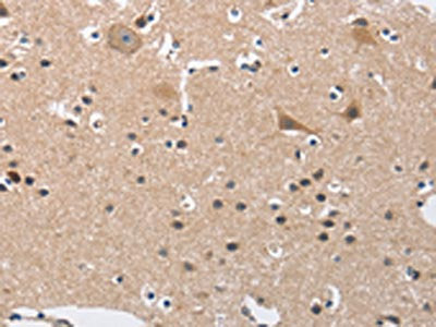 The image on the left is immunohistochemistry of paraffin-embedded Human brain tissue using CSB-PA472830(BUB1 Antibody) at dilution 1/50, on the right is treated with fusion protein. (Original magnification: ×200)