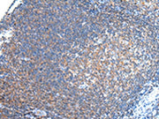 The image on the left is immunohistochemistry of paraffin-embedded Human tonsil tissue using CSB-PA472895(PCDHA6 Antibody) at dilution 1/20, on the right is treated with synthetic peptide. (Original magnification: ×200)