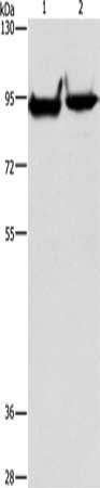 Gel: 6%SDS-PAGE, Lysate: 40 ug, Lane 1-2: Mouse heart tissue, Mouse brain tissue, Primary antibody: CSB-PA473505(MARK1 Antibody) at dilution 1/500, Secondary antibody: Goat anti rabbit IgG at 1/8000 dilution, Exposure time: 40 seconds