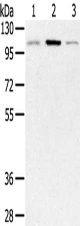 Gel: 8%SDS-PAGE, Lysate: 40 ug, Lane 1-3: Human fetal muscle tissue, mouse brain tissue, Mouse heart tissue, Primary antibody: CSB-PA474216(PYGM Antibody) at dilution 1/450, Secondary antibody: Goat anti rabbit IgG at 1/8000 dilution, Exposure tim...