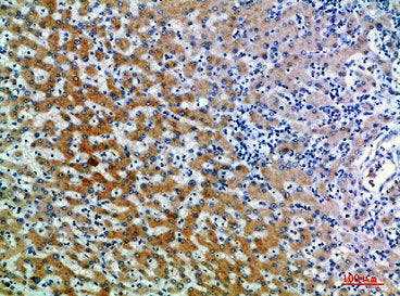 Immunohistochemical analysis of paraffin-embedded human-liver, antibody was diluted at 1:200