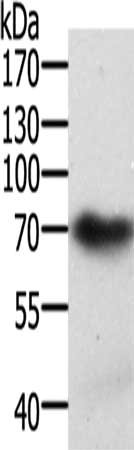 Gel: 10%SDS-PAGE, Lysate: 40 ug, Lane: Mouse brain tissue, Primary antibody: CSB-PA477766(SPDL1 Antibody) at dilution 1/300, Secondary antibody: Goat anti rabbit IgG at 1/8000 dilution, Exposure time: 2 minutes