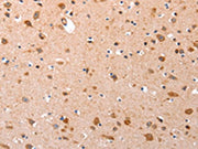 The image on the left is immunohistochemistry of paraffin-embedded Human brain tissue using CSB-PA478144(GATA6 Antibody) at dilution 1/35, on the right is treated with synthetic peptide. (Original magnification: ×200)