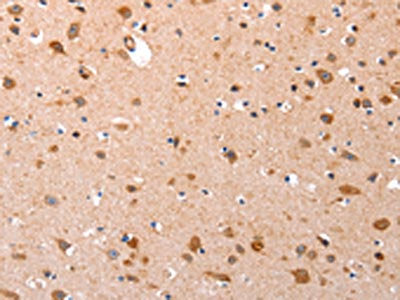 The image on the left is immunohistochemistry of paraffin-embedded Human brain tissue using CSB-PA478144(GATA6 Antibody) at dilution 1/35, on the right is treated with synthetic peptide. (Original magnification: ×200)