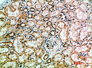 Immunohistochemical analysis of paraffin-embedded human-kidney, antibody was diluted at 1:200