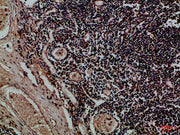 Immunohistochemical analysis of paraffin-embedded Human-tonsil, antibody was diluted at 1:100