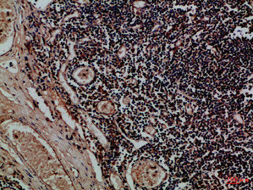 Immunohistochemical analysis of paraffin-embedded Human-tonsil, antibody was diluted at 1:100