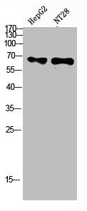 Western Blot analysis of hepg2, NT28 cells using Antibody diluted at 500. Secondary antibody was diluted at 1:20000