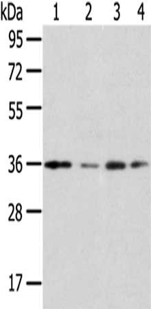 Gel: 8%SDS-PAGE,Lysate: 40 ug,Lane 1-4: Jurkat cells, A549 cells, HepG2 cells, 293T cells,Primary antibody: CSB-PA505593(HOXD13 Antibody) at dilution 1/200 dilution,Secondary antibody: Goat anti rabbit IgG at 1/8000 dilution,Exposure time: 30 seconds