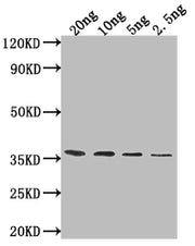 Western Blot Positive WB detected in Recombinant protein All lanes: ATG32 antibody at 1:2000 Secondary Goat polyclonal to rabbit IgG at 1/50000 dilution Predicted band size: 32.8 kDa Observed band size: 35 kDa