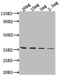 Western Blot Positive WB detected in Recombinant protein All lanes: ATG32 antibody at 1:2000 Secondary Goat polyclonal to rabbit IgG at 1/50000 dilution Predicted band size: 32.8 kDa Observed band size: 35 kDa