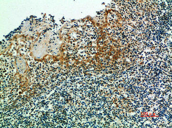 Immunohistochemical analysis of paraffin-embedded human-tonsils, antibody was diluted at 1:200