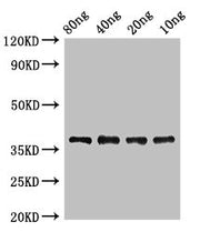 Western Blot Positive WB detected in Recombinant protein All lanes: lplA antibody at 2ug/ml Secondary Goat polyclonal to rabbit IgG at 1/50000 dilution predicted band size: 38 kDa observed band size: 38 kDa