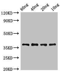 Western Blot Positive WB detected in Recombinant protein All lanes: lplA antibody at 2ug/ml Secondary Goat polyclonal to rabbit IgG at 1/50000 dilution predicted band size: 38 kDa observed band size: 38 kDa