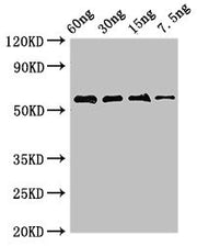 Western Blot Positive WB detected in Recombinant protein All lanes: AK antibody at 2.8µg/ml Secondary Goat polyclonal to rabbit IgG at 1/50000 dilution Predicted band size: 55 kDa Observed band size: 55 kDa