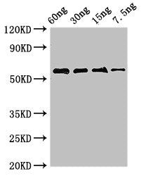 Western Blot Positive WB detected in Recombinant protein All lanes: AK antibody at 2.8µg/ml Secondary Goat polyclonal to rabbit IgG at 1/50000 dilution Predicted band size: 55 kDa Observed band size: 55 kDa