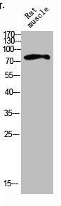 Western blot analysis of RAT-MUSLE lysis using IL4R antibody. Antibody was diluted at 1:500. Secondary antibody was diluted at 1:20000