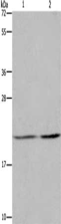 Gel: 8%SDS-PAGE, Lysate: 40 ug, Lane 1-2: A549 cells, Hela cells, Primary antibody: CSB-PA512932(ASF1A Antibody) at dilution 1/1200, Secondary antibody: Goat anti rabbit IgG at 1/8000 dilution, Exposure time: 20 seconds