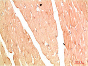 Immunohistochemical analysis of paraffin-embedded Human Skeletal Muslce Tissue using NBR1 Rabbit pAb diluted at 1:200