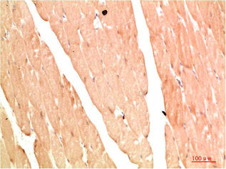 Immunohistochemical analysis of paraffin-embedded Human Skeletal Muslce Tissue using NBR1 Rabbit pAb diluted at 1:200
