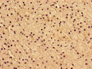 Immunohistochemistry of paraffin-embedded human adrenal gland tissue using CSB-PA516850LA01HU at dilution of 1:100