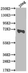 Western Blot Positive WB detected in Recombinant protein All lanes: mtr antibody at 1:2000 Secondary Goat polyclonal to rabbit IgG at 1/50000 dilution Predicted band size: 69.9 kDa Observed band size: 67 kDa
