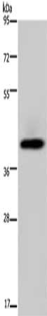 Gel: 8%SDS-PAGE, Lysate: 40 ug, Lane: Human fetal liver tissue, Primary antibody: CSB-PA517460(SERPINB3 Antibody) at dilution 1/200, Secondary antibody: Goat anti rabbit IgG at 1/8000 dilution, Exposure time: 10 seconds
